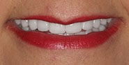 After Image: Case 286 - front