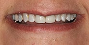 Before Image: Case 286 - front