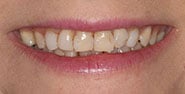 Before Image: Case 288 - front