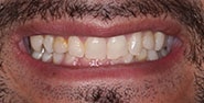 Before Image: Case 291 - front