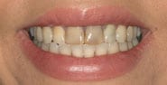 Before Image: Case 296 - front