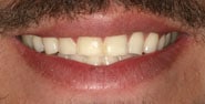 Before Image: Case 297 - front