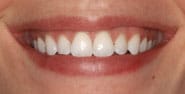 Before Image: Case 298 - front