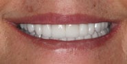 After Image: Case 299 - front