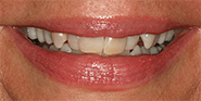 Before Image: Case 30 - front