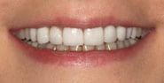 Before Image: Case 303 - front