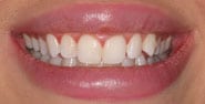 Before Image: Case 307 - front