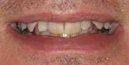 Before Image: Case 308 - front