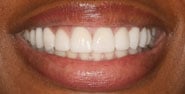After Image: Case 309 - front