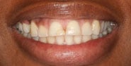 Before Image: Case 309 - front