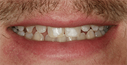 Before Image: Case 31 - front