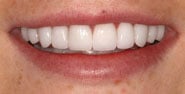 After Image: Case 311 - front