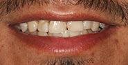 Before Image: Case 328 - front