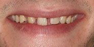 Before Image: Case 343 - front