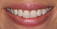 Before Image: Case 344 - front