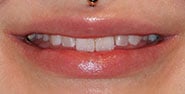Before Image: Case 347 - front