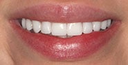 After Image: Case 349 - front