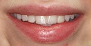 Before Image: Case 349 - front