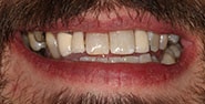Before Image: Case 351 - front