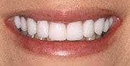 After Image: Case 355 - front