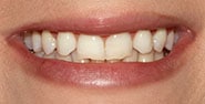 Before Image: Case 355 - front