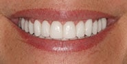 After Image: Case 356 - front