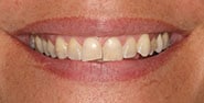 Before Image: Case 356 - front