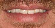 Before Image: Case 357 - front