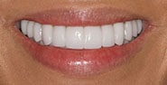 After Image: Case 359 - front