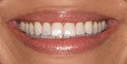 Before Image: Case 359 - front