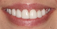 After Image: Case 360 - front
