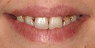 Before Image: Case 360 - front