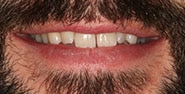 Before Image: Case 362 - front