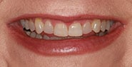 Before Image: Case 367 - front