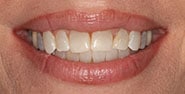 Before Image: Case 368 - front