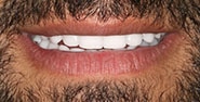 After Image: Case 369 - front