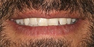 Before Image: Case 369 - front