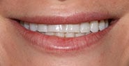 Before Image: Case 371 - front