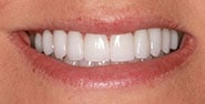After Image: Case 373 - front