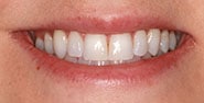 Before Image: Case 373 - front