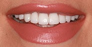After Image: Case 375 - front