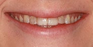 Before Image: Case 384 - front