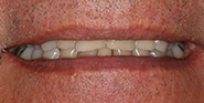 Before Image: Case 39 - front