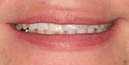Before Image: Case 391 - front