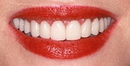 After Image: Case 393 - front