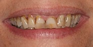 Before Image: Case 396 - front
