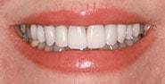 After Image: Case 397 - front