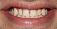 Before Image: Case 398 - front