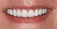 After Image: Case 399 - front