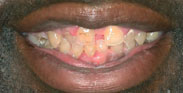 Before Image: Case 4 - front